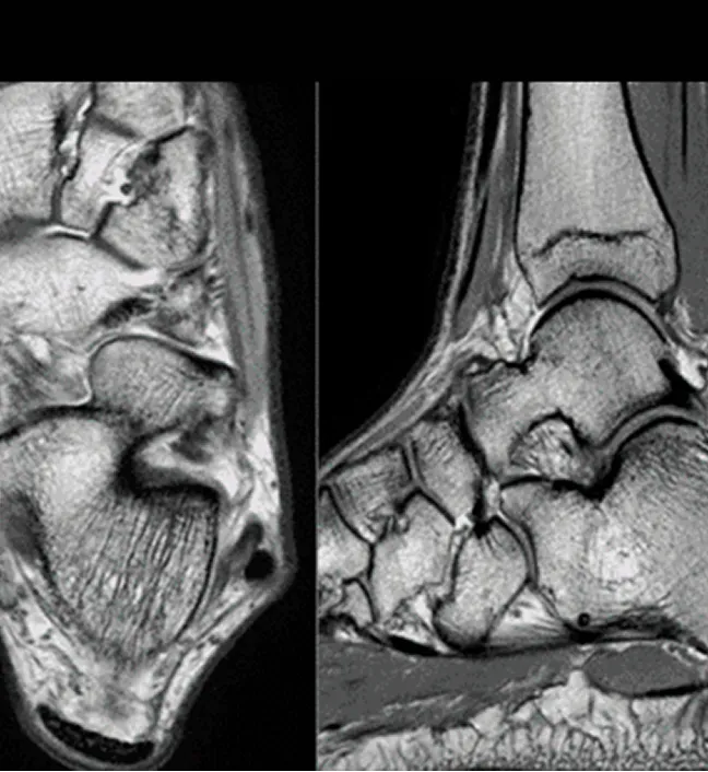 Ảnh MRI bàn chân và cổ chân