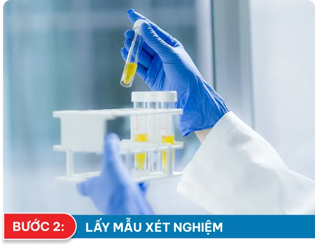 Bước 2: Lấy máu xét nghiệm