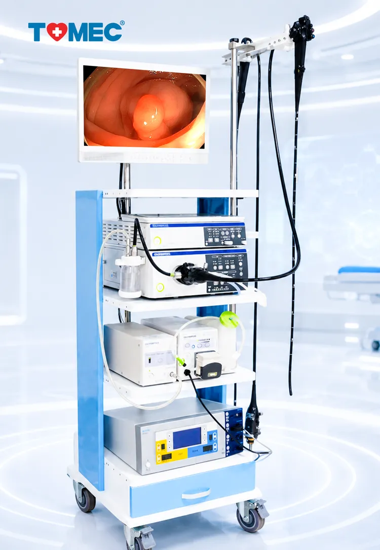 Máy nội soi tiêu hóa hiện đại tại TOMEC