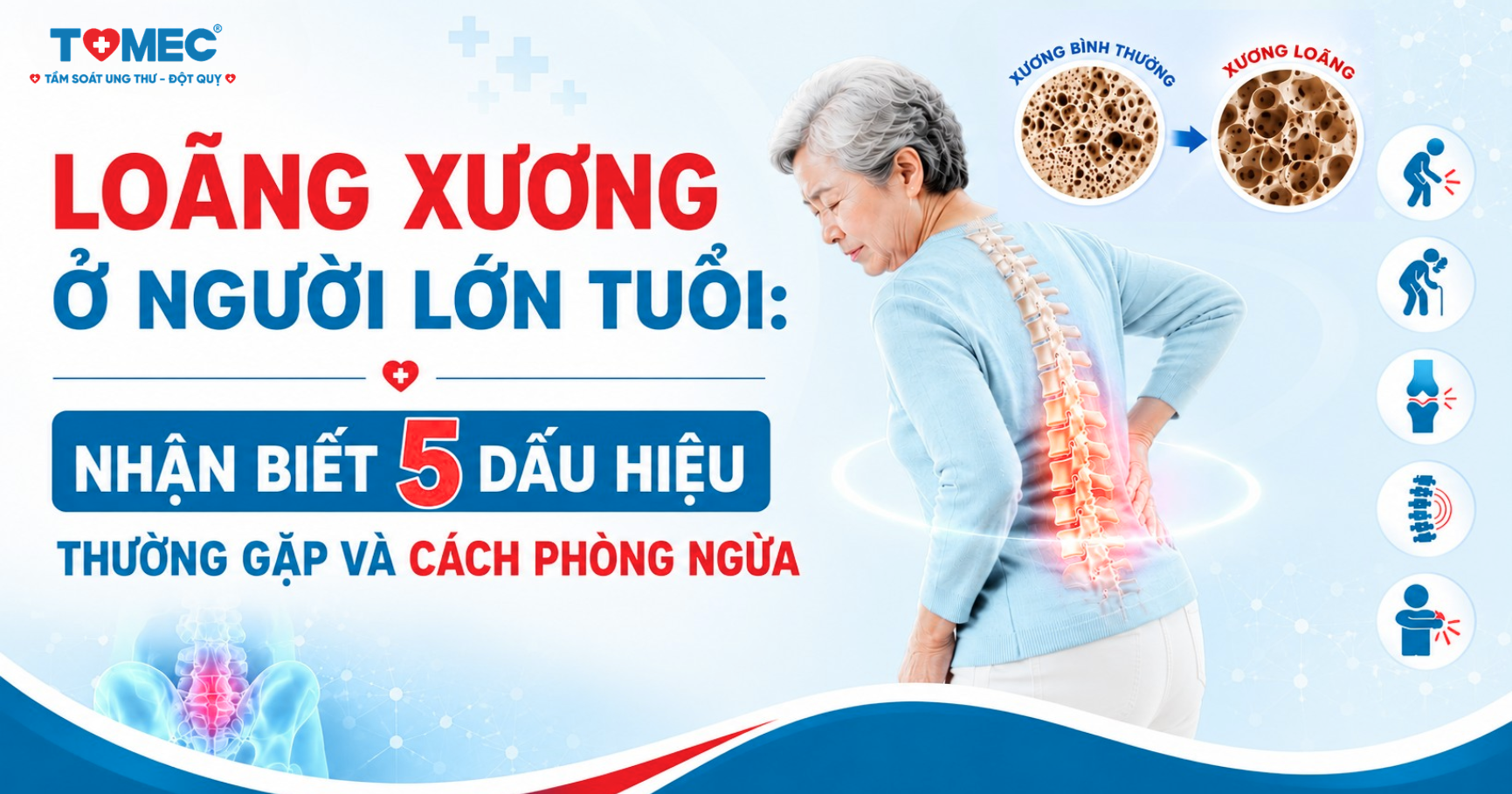 Loãng xương ở người lớn tuổi
