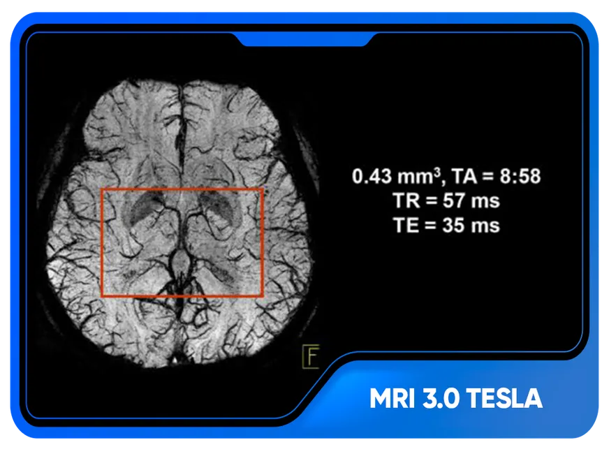 Kết quả chụp bằng máy MRI 3.0 Tesla