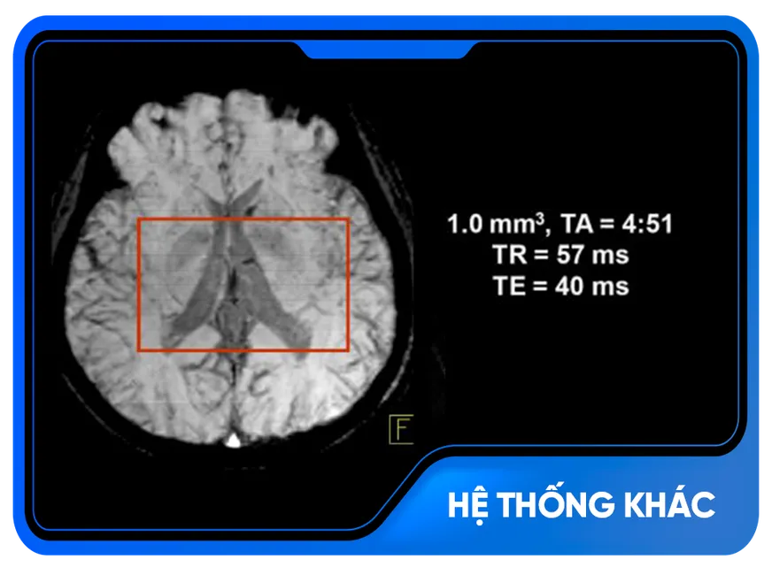 Kết quả chụp cộng hưởng từ bằng hệ thống khác