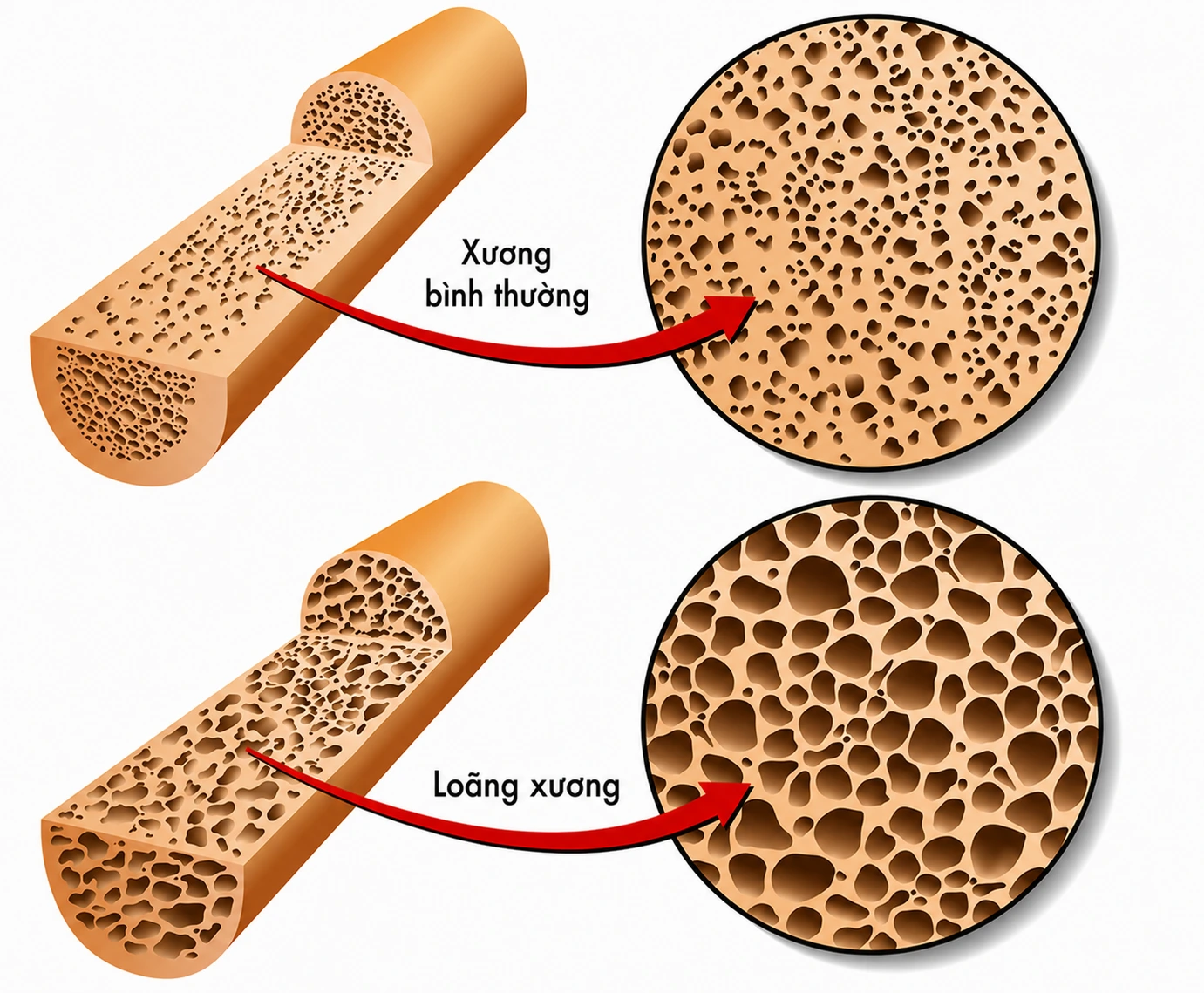 Đo mật độ xương định kỳ giúp sớm phát hiện tình trạng loãng xương