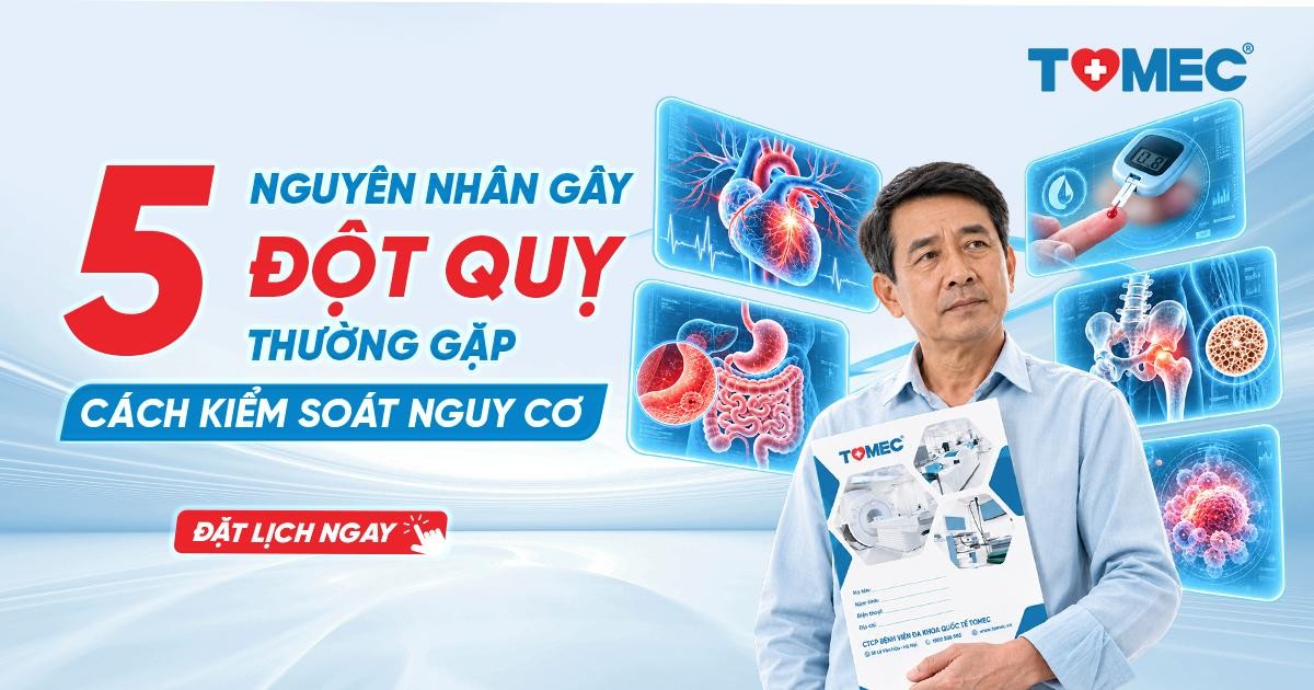 5 nguyên nhân gây đột quỵ thường gặp và cách kiểm soát nguy cơ