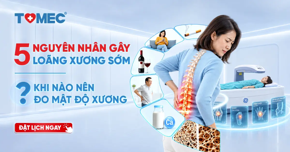 5 nguyên nhân gây loãng xương sớm và khi nào nên đo mật độ xương