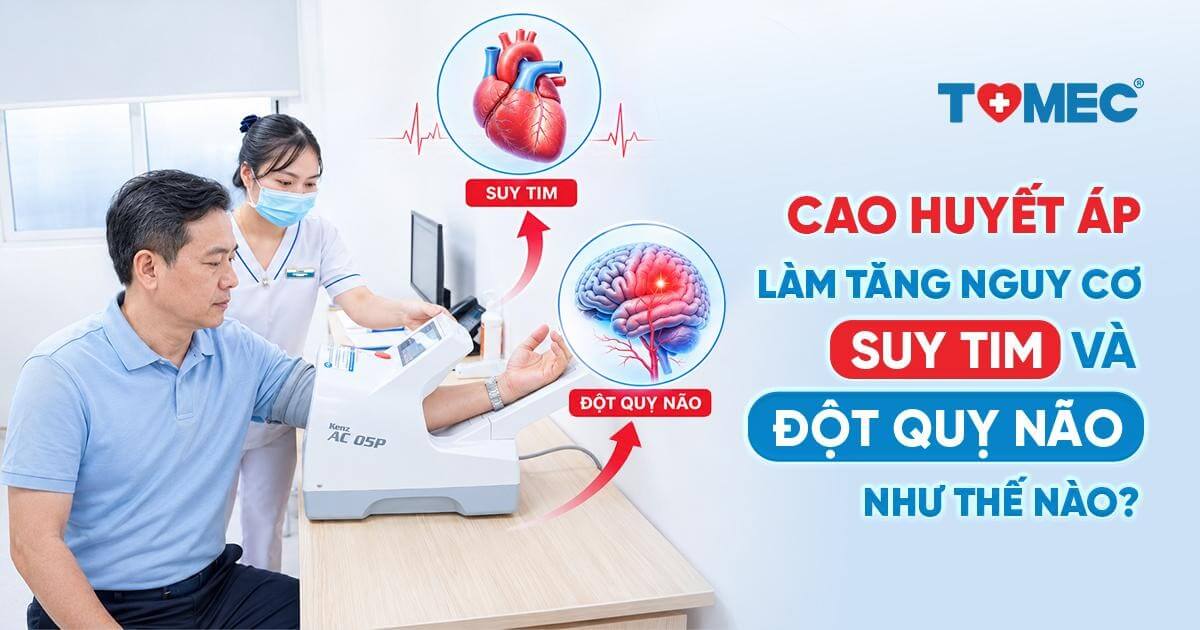 Cao huyết áp làm tăng nguy cơ suy tim và đột quỵ não như thế nào
