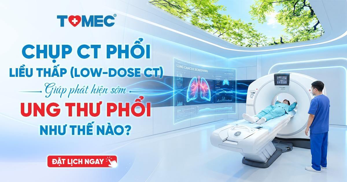 Chụp CT phổi liều thấp (Low-dose CT) giúp phát hiện sớm ung thư phổi như thế nào
