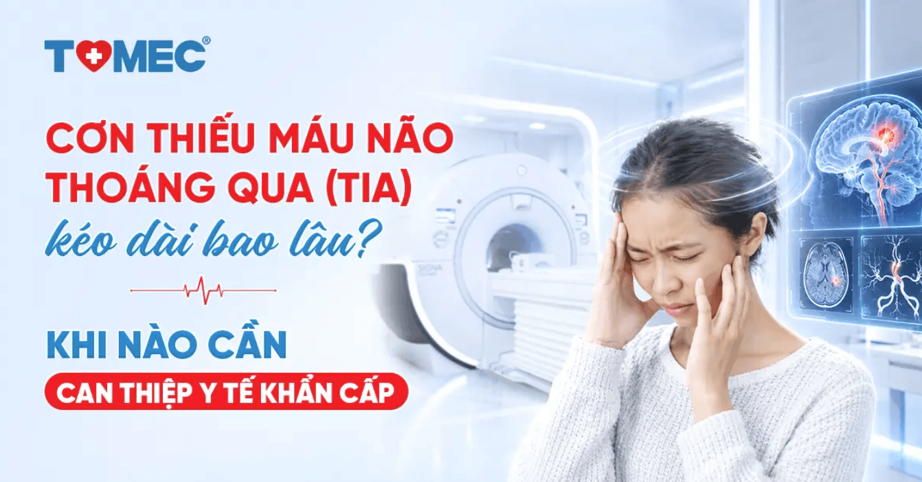 Cơn thiếu máu não thoáng qua (TIA) kéo dài bao lâu và khi nào cần can thiệp y tế khẩn cấp