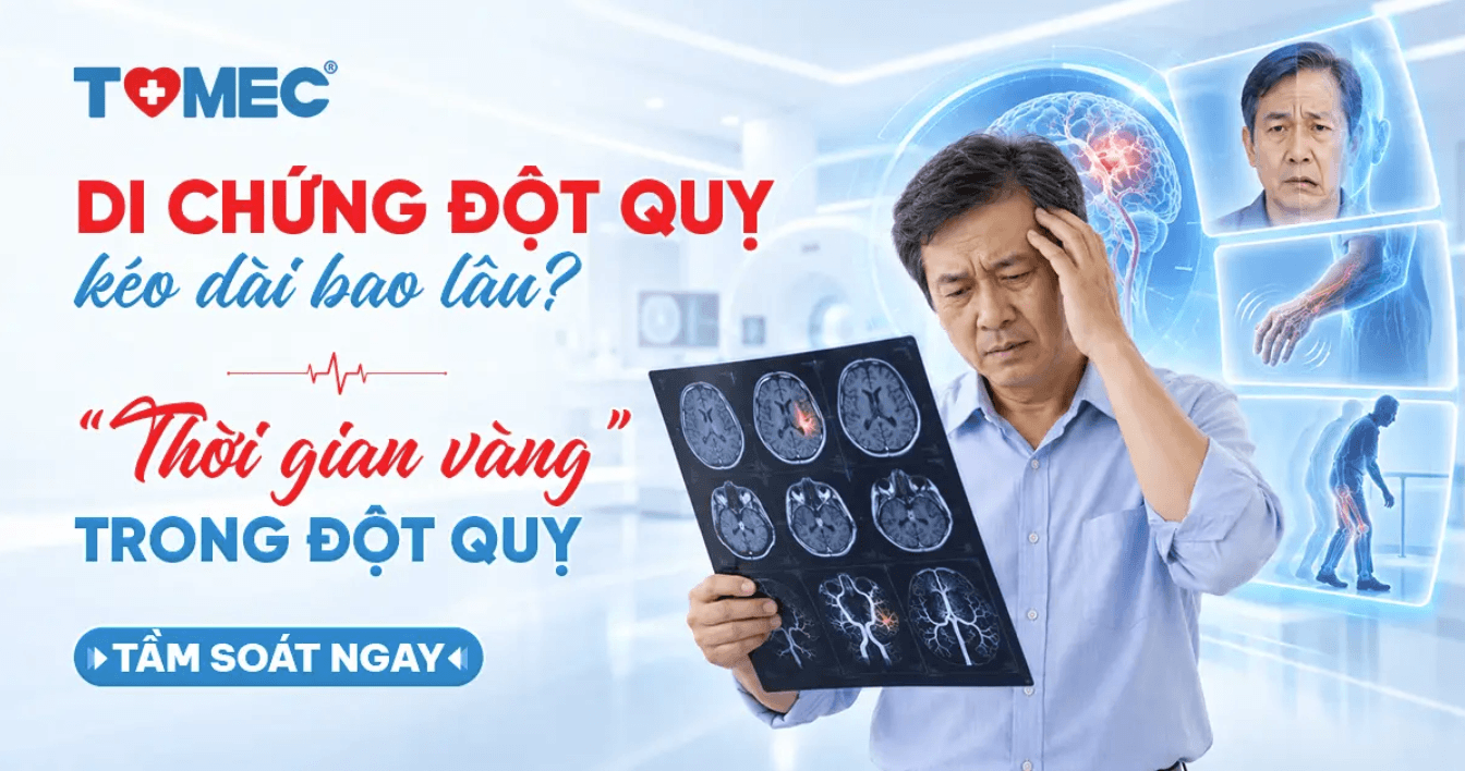 Di chứng đột quỵ kéo dài bao lâu Vai trò của “thời gian vàng” trong đột quỵ