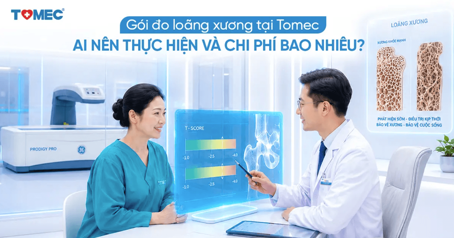 Gói đo loãng xương tại Tomec Ai nên thực hiện và chi phí bao nhiêu