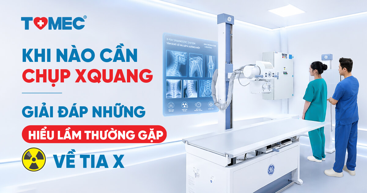 Khi nào cần chụp X-quang Giải đáp những hiểu lầm thường gặp về tia X