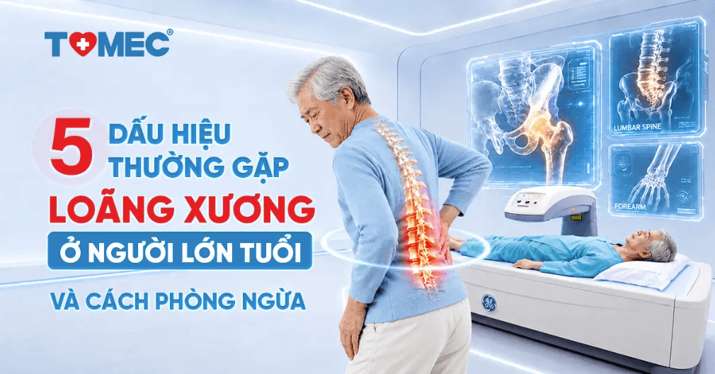 Loãng xương ở người lớn tuổi Nhận biết 5 dấu hiệu thường gặp và cách phòng ngừa