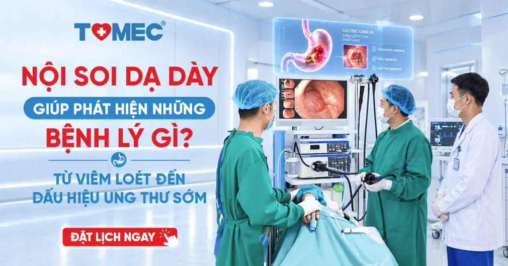 Nội soi dạ dày giúp phát hiện những bệnh lý gì Từ viêm loét đến dấu hiệu ung thư sớm