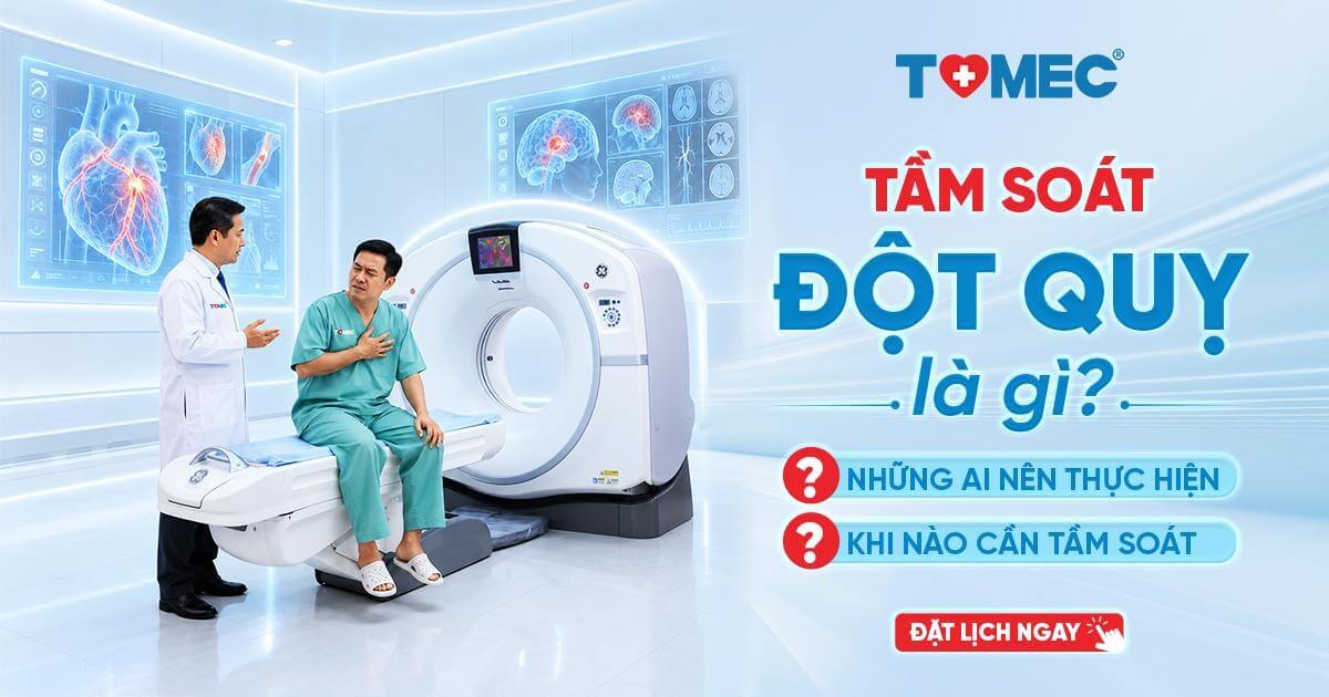 Tầm soát đột quỵ là gì Ai nên thực hiện và khi nào cần tầm soát