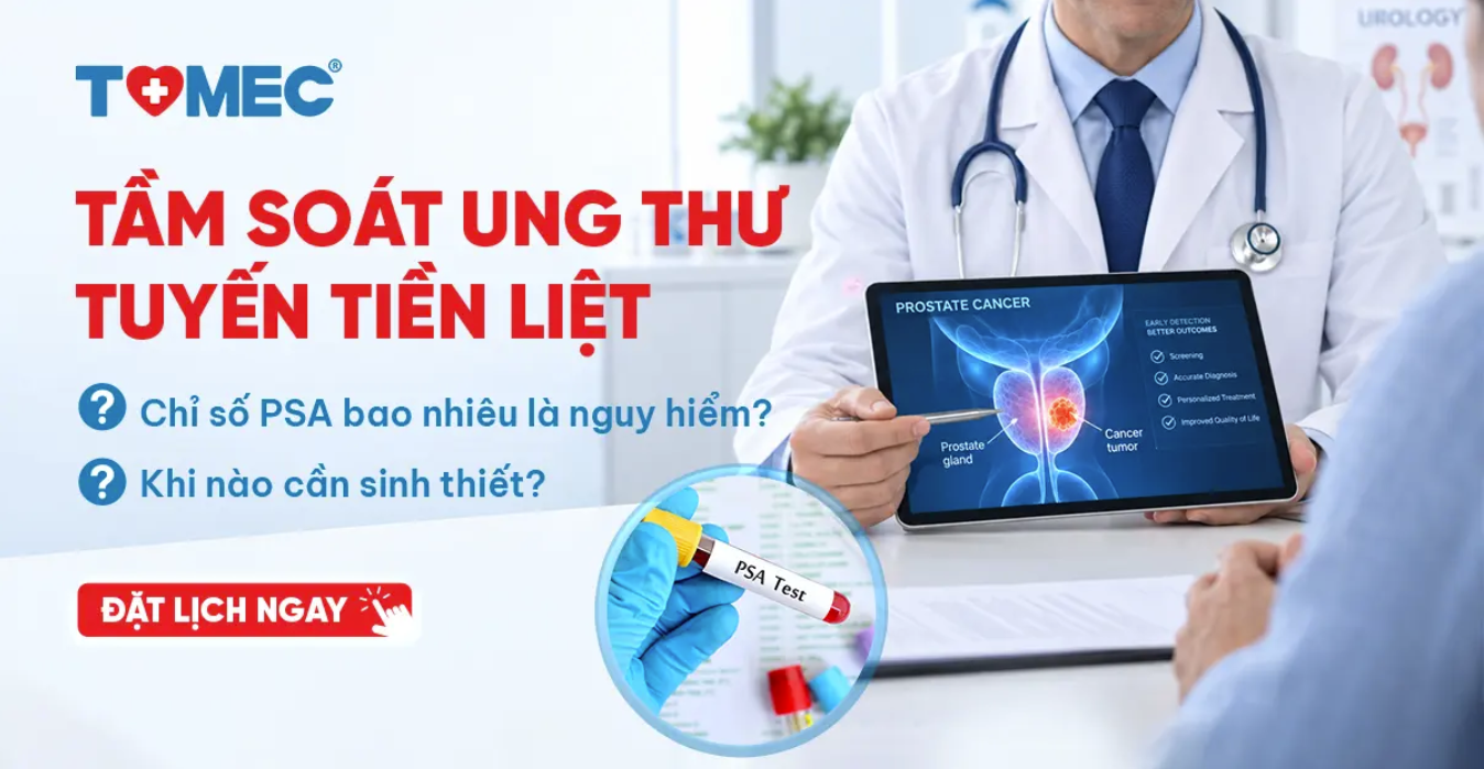 Tầm soát ung thư tuyến tiền liệt Chỉ số PSA bao nhiêu là nguy hiểm và khi nào cần thực hiện sinh thiết