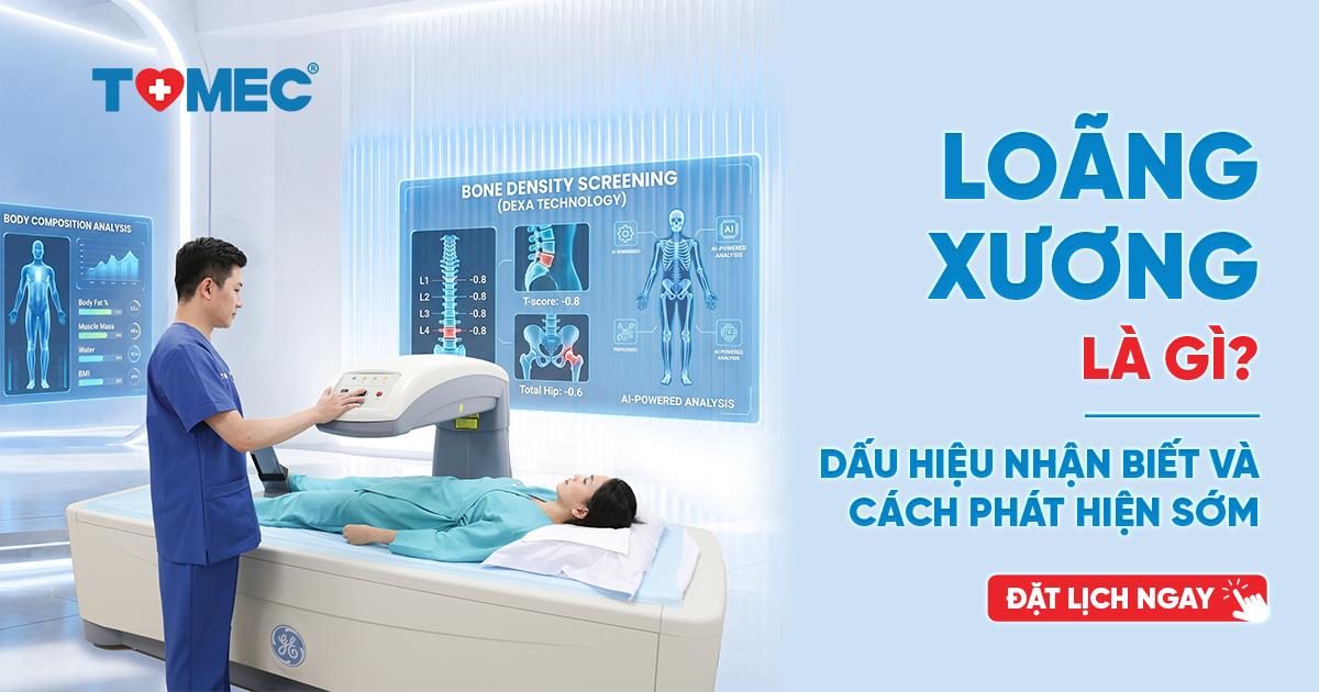 Loãng xương là gì? Dấu hiệu nhận biết và cách phát hiện sớm
