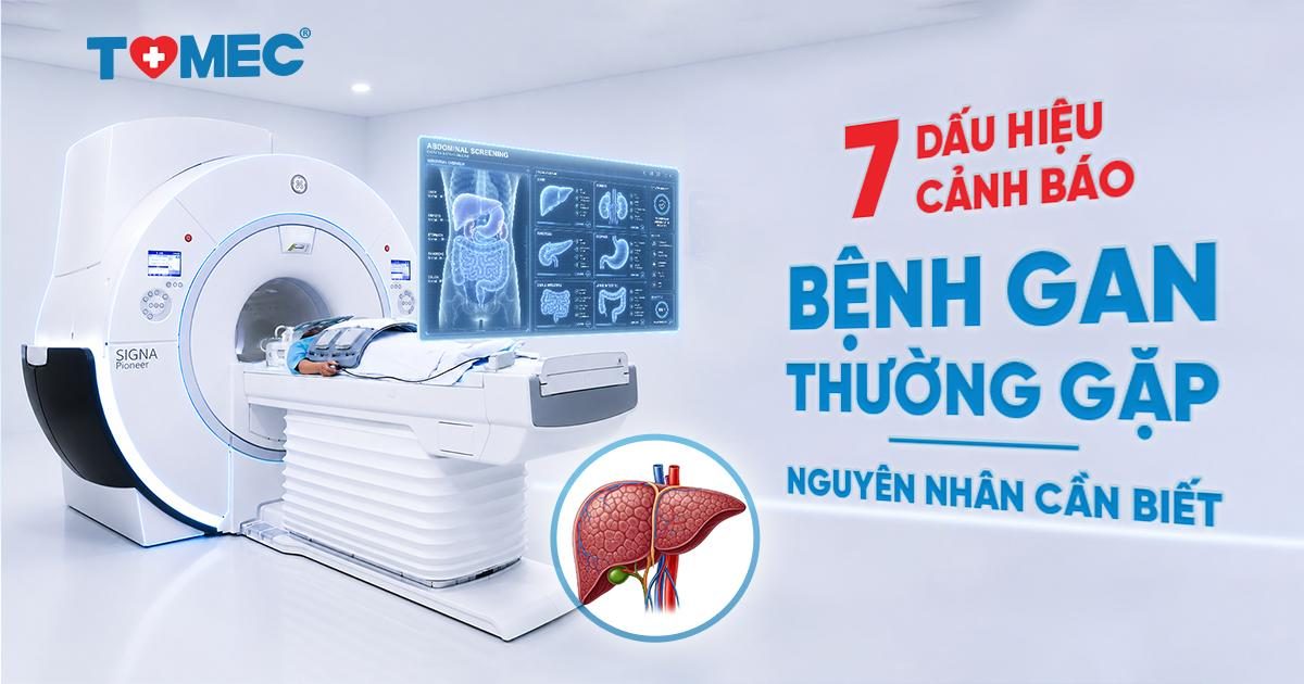 7 dấu hiệu cảnh báo bệnh gan thường gặp và nguyên nhân cần biết