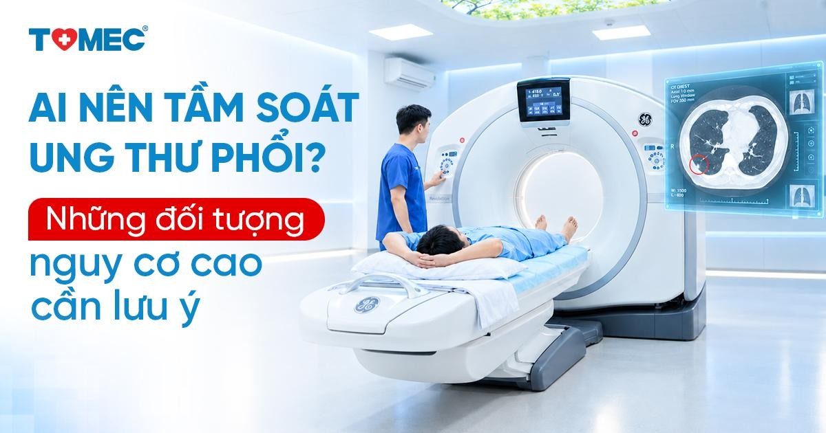 Ai nên tầm soát ung thư phổi Những đối tượng nguy cơ cao cần lưu ý