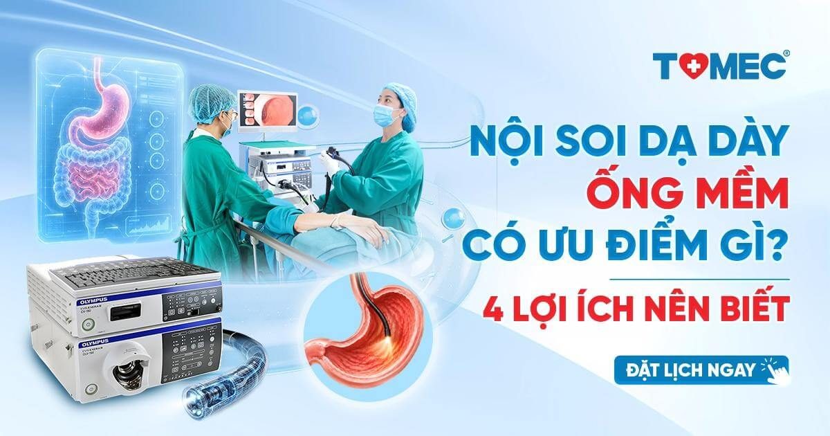Nội soi dạ dày ống mềm có ưu điểm gì 4 lợi ích người bệnh nên biết