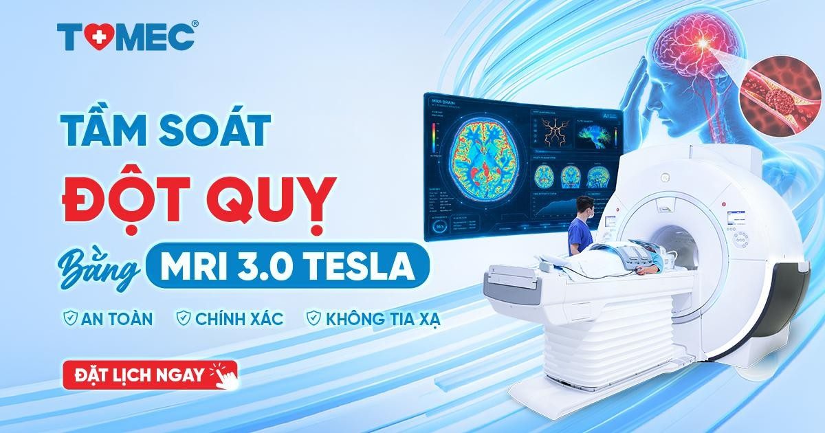 Tầm soát đột quỵ bằng MRI 3.0 Tesla An toàn, chính xác, không tia xạ