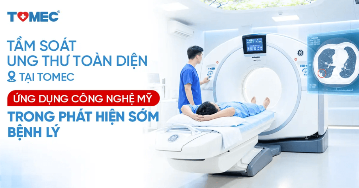 Tầm soát ung thư toàn diện tại TOMEC Ứng dụng công nghệ Mỹ trong phát hiện sớm bệnh lý