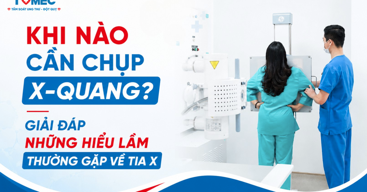 Khi nào cần chụp X-quang? Giải đáp những hiểu lầm thường gặp về tia X