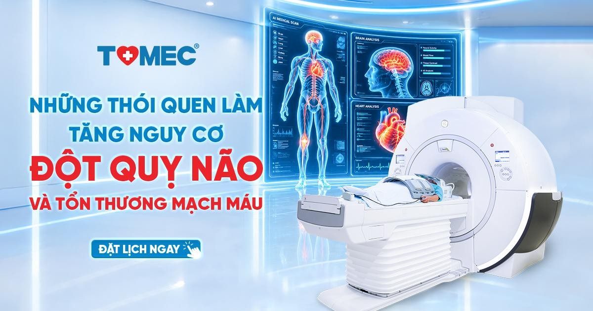 những thói quen làm tăng nguy cơ đột quỵ não